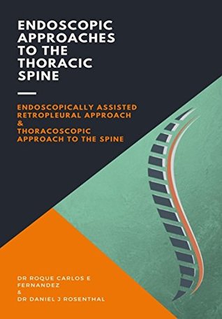 Download Endoscopic Approaches to the Thoracic Spine: Endoscopically assisted retropleural approach & Thoracoscopic approach to the spine - Roque Carlos E Fernandez file in ePub